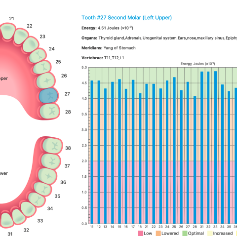 Dental Tab 牙齿图表扩展 产品图